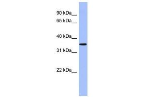 PPM1A antibody used at 1 ug/ml to detect target protein.