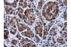Immunohistochemistry (IHC) image for anti-Hydroxysteroid (17-Beta) Dehydrogenase 10 (HSD17B10) antibody (ABIN1498724)