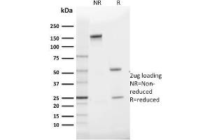 SDS-PAGE Analysis Purified GLUT-1 Mouse Monoclonal Antibody (GLUT1/2475).