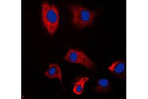 Immunofluorescent analysis of PSMD2 staining in HeLa cells. (PSMD2 antibody  (N-Term))