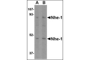Western blot analysis of Nhe-1 in rat kidney tissue lysate with in with this product at (A) 1 and (B) 2 μg/ml. (SLC9A1 antibody  (C-Term, N-Term))