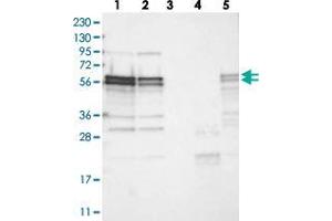 Western blot analysis of Lane 1: RT-4, Lane 2: U-251 MG, Lane 3: Human Plasma, Lane 4: Liver, Lane 5: Tonsil with ZC3H15 polyclonal antibody  at 1:250-1:500 dilution.