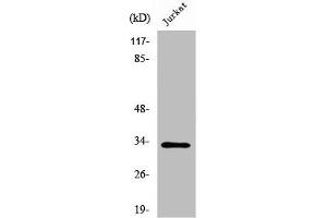 Western Blot analysis of Jurkat cells using UCP3 Polyclonal Antibody (UCP3 antibody  (C-Term))