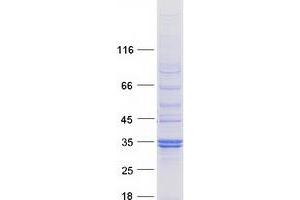 Western Blotting (WB) image for SplA/ryanodine Receptor Domain and SOCS Box Containing 2 (SPSB2) protein (Myc-DYKDDDDK Tag) (ABIN2732625)