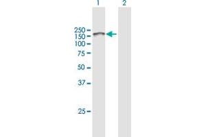 Western Blot analysis of ITGA6 expression in transfected 293T cell line by ITGA6 MaxPab polyclonal antibody. (ITGA6 antibody  (AA 1-1073))