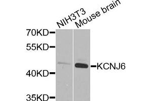 Western blot analysis of extracts of NIH3T3 and mouse brain cells, using KCNJ6 antibody. (KCNJ6 antibody)