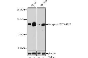 Western blot analysis of extracts of various cell lines, using Phospho-ST-S727 Rabbit mAb (ABIN6135339, ABIN6136294, ABIN6136295 and ABIN7101885) at 1:1000 dilution. (STAT3 antibody  (pSer727))