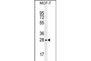 LGALS3 Antibody (C-term) (ABIN655879 and ABIN2845280) western blot analysis in MCF-7 cell line lysates (35 μg/lane). (Galectin 3 antibody  (C-Term))