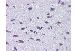Immunohistochemistry (IHC) image for anti-Diencephalon/mesencephalon Homeobox 1 (DMBX1) (Middle Region) antibody (ABIN2780096)