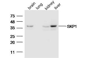 Lane 1: Mouse brain lysates Lane 2: Mouse lung Lane 3: Mouse Kidney Lane 4: Mouse Liver probed with Anti-SKP1 Polyclonal Antibody, Unconjugated  at 1:5000 for 90 min at 37˚C. (SKP1 antibody  (AA 81-163))