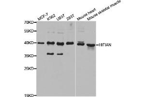 Western blot analysis of extracts of various cell lines, using HIF1AN antibody (ABIN5973179) at 1/1000 dilution. (HIF1AN antibody)