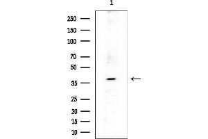 anti-SH2 Domain Containing 5 (SH2D5) (C-Term) antibody