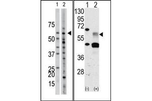 Image no. 1 for anti-Activin Receptor Type I (ACRV1) (Middle Region) antibody (ABIN360123) (ACVR1 antibody  (Middle Region))