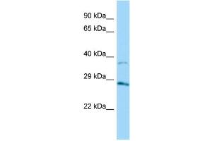 Host: Rabbit Target Name: AKR1B15 Sample Type: HT1080 Whole Cell lysates Antibody Dilution: 1. (AKR1B15 antibody  (C-Term))
