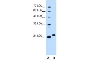 C1ORF159 antibody used at 0. (C1orf159 antibody  (Middle Region))