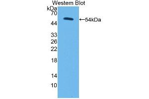 Detection of Recombinant PC, Human using Polyclonal Antibody to Pyruvate Carboxylase (PC)