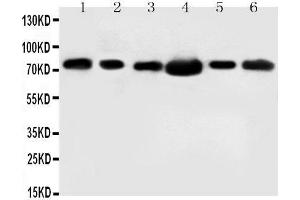 Anti-FAF1 antibody, Western blotting Lane 1: Rat Testis Tissue Lysate Lane 2: MM453 Cell Lysate Lane 3: MM231 Cell Lysate Lane 4: HELA Cell Lysate Lane 5: SMMC Cell Lysate Lane 6: SW620 Cell Lysate (FAF1 antibody  (N-Term))