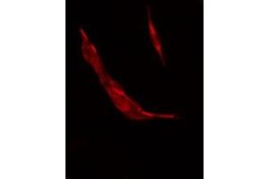 ABIN6278637 staining COLO205 by IF/ICC. (TAAR3 antibody)