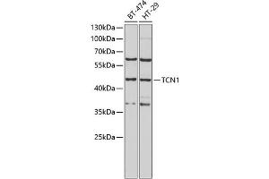 Western blot analysis of extracts of various cell lines, using TCN1 antibody (ABIN6132752, ABIN6148950, ABIN6148951 and ABIN6222050) at 1:1000 dilution.