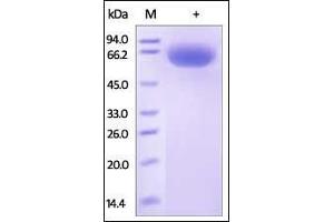 SDS-PAGE (SDS) image for CD33 (CD33) (AA 18-259) protein (Fc Tag) (ABIN2180758) (CD33 Protein (CD33) (AA 18-259) (Fc Tag))