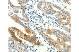 Immunohistochemistry (IHC) image for anti-Transient Receptor Potential Cation Channel, Subfamily A, Member 1 (TRPA1) antibody (ABIN2432369)