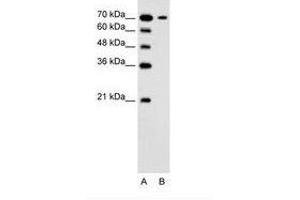 Image no. 1 for anti-Solute Carrier Family 5 (Low Affinity Glucose Cotransporter), Member 4 (SLC5A4) (N-Term) antibody (ABIN205017) (SLC5A4 antibody  (N-Term))