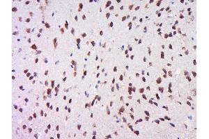 Paraformaldehyde-fixed, paraffin embedded rat brain, Antigen retrieval by boiling in sodium citrate buffer (pH6) for 15min, Block endogenous peroxidase by 3% hydrogen peroxide for 30 minutes, Blocking buffer (normal goat serum) at 37°C for 20min, Antibody incubation with Rabbit Anti-MSK1 (Ser212) Polyclonal Antibody, Unconjugated  at 1:500 overnight at 4°C, followed by a conjugated secondary for 90 minutes and DAB staining. (MSK1 antibody  (pSer212))