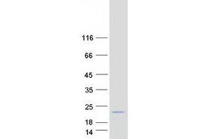 Cornichon Homolog 2 (CNIH2) protein (Myc-DYKDDDDK Tag)