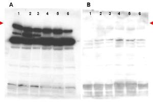 Image no. 2 for anti-Pogo Transposable Element with ZNF Domain (POGZ) (N-Term) antibody (ABIN401435) (POGZ antibody  (N-Term))