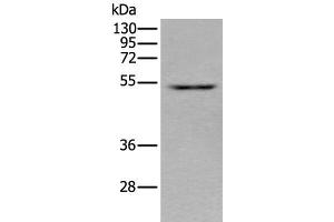 Western blot analysis of HEPG2 cell lysate using ZNF672 Polyclonal Antibody at dilution of 1:350 (ZNF672 antibody)