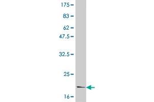 Western Blot detection against Immunogen (21 KDa) . (IL-6 antibody  (AA 29-212))