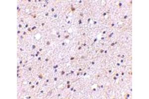 Immunohistochemical staining of human brain tissue with 5 ug/mL CADPS polyclonal antibody .