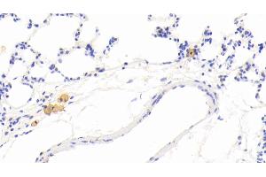 Detection of MMP12 in Rat Lung Tissue using Polyclonal Antibody to Matrix Metalloproteinase 12 (MMP12) (MMP12 antibody  (AA 372-463))