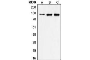 Western blot analysis of Focal Adhesion Kinase expression in A431 (A), HeLa (B), MDAMB231 (C) whole cell lysates. (FAK antibody  (Center))