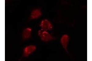 ABIN6277178 staining MCF7 by IF/ICC. (Claudin 1 antibody  (C-Term))