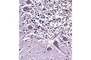 NC Antibody (C-term) ((ABIN657952 and ABIN2846897))immunohistochemistry analysis in formalin fixed and paraffin embedded human cerebellum tissue followed by peroxidase conjugation of the secondary antibody and DAB staining. (NPPC antibody  (C-Term))