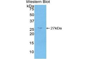 Detection of Recombinant CAMK2g, Human using Polyclonal Antibody to Calcium/Calmodulin Dependent Protein Kinase II Gamma (CAMK2g) (CAMKII gamma antibody  (AA 6-208))