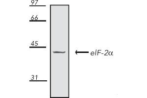 Western Blotting (WB) image for anti-Eukaryotic Translation Initiation Factor 2A, 65kDa (EIF2A) antibody (ABIN7211398) (EIF2A antibody)