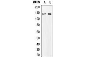 Western blot analysis of MN1 expression in K562 (A), NIH3T3 (B) whole cell lysates. (Meningioma 1 antibody  (Center))