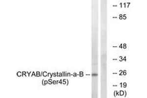 Western blot analysis of extracts from COS7 cells treated with anisomycin 25ug/ml 30', using CRYAB (Phospho-Ser45) Antibody. (CRYAB antibody  (pSer45))