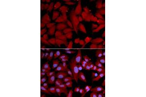 Immunofluorescence (IF) image for anti-Proteasome Subunit alpha 4 (PSMA4) (AA 1-261) antibody (ABIN3023325) (PSMA4 antibody  (AA 1-261))