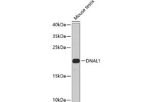 Western blot analysis of extracts of mouse testis, using DN antibody (ABIN6127820, ABIN6139729, ABIN6139731 and ABIN6224283) at 1:1000 dilution. (DNAL1 antibody  (AA 41-190))