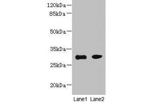 Western blot All lanes: PI4KAP1 antibody at 10 μg/mL Lane 1: Mouse gonadal tissue Lane 2: 293T whole cell lysate Secondary Goat polyclonal to rabbit IgG at 1/10000 dilution Predicted band size: 30 kDa Observed band size: 30 kDa (PI4KAP1 antibody  (AA 1-262))