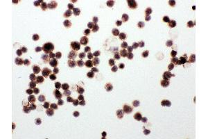 Anti-WISP1 antibody, ICC ICC: MCF-7 Cell (WISP1 antibody  (C-Term))