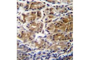 Immunohistochemistry analysis in formalin fixed and paraffin embedded human stomach tissue reacted with PDPR Antibody (C-term) followed by peroxidase conjugation of the secondary antibody and DAB staining. (PDPR antibody  (C-Term))