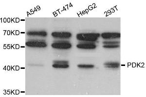 Western Blotting (WB) image for anti-Pyruvate Dehydrogenase Kinase, Isozyme 2 (PDK2) (AA 128-407) antibody (ABIN1681304) (PDK2 antibody  (AA 128-407))