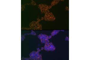 Immunofluorescence analysis of Jurkat cells using CD3G Rabbit mAb (ABIN1682574, ABIN3018517, ABIN3018518 and ABIN7101622) at dilution of 1:100 (40x lens). (CD3G antibody)