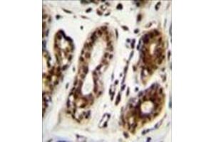 Formalin fixed, paraffin embedded human breast tissue stained with Nucleolin Antibody (Center) followed by peroxidase conjugation of the secondary antibody and DAB staining. (Nucleolin antibody  (Middle Region))