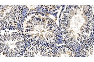 Detection of TBK1 in Mouse Testis Tissue using Polyclonal Antibody to TANK Binding Kinase 1 (TBK1) (TBK1 antibody  (AA 9-310))