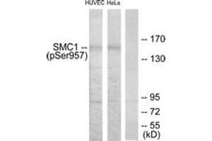Western blot analysis of extracts from HuvEc cells treated with EGF 200ng/ml 5'/HeLa cells treated with EGF 200ng/ml 15', using SMC1 (Phospho-Ser957) Antibody. (SMC1A antibody  (pSer957))